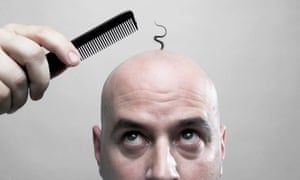 Can Balding Hair Grow Back Dubai Abu Dhabi