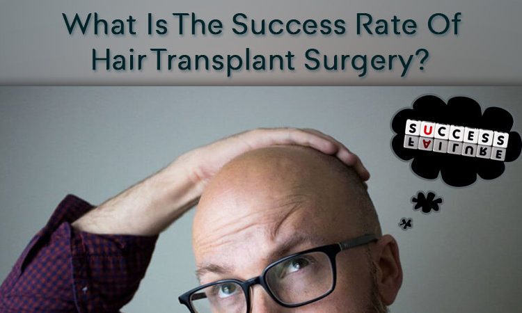What is the Success Rate of Hair Transplant