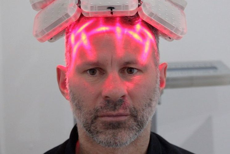 Laser Hair Therapy for Hair Loss